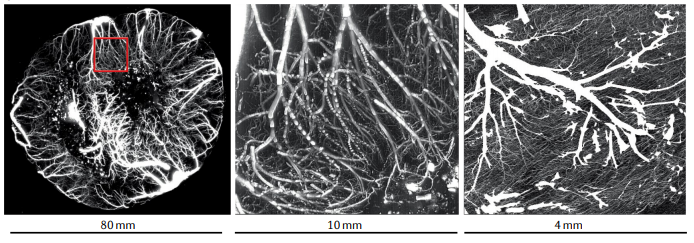Clinical quantitative cardiac imaging for the assessment of myocardial ...